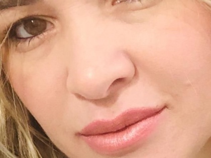 Harmonização Facial