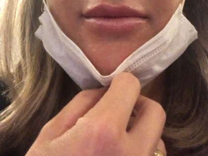 Harmonização Facial