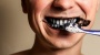 Carvão para clarear os dentes? De jeito nenhum! Clareamento somente com acompanhamento na Rennovar!