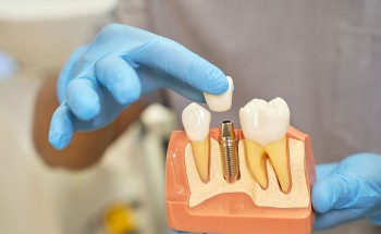 Implante dentário em pacientes com perda óssea