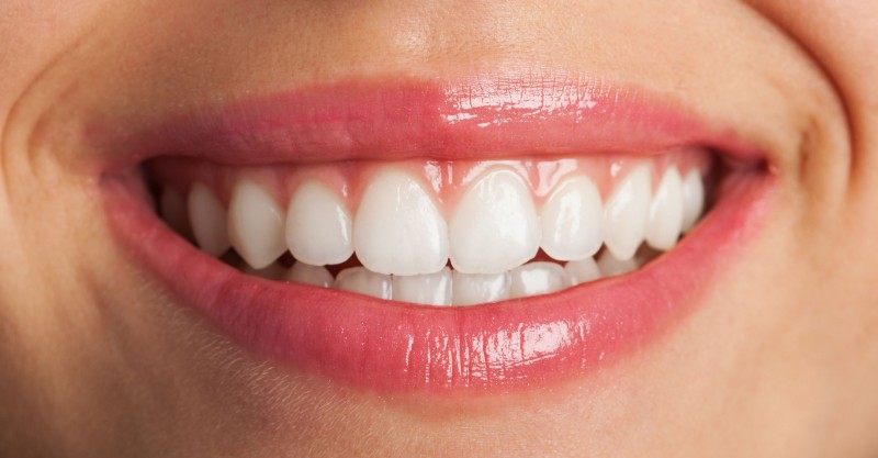 Clareamento Dental: Como é Feito?