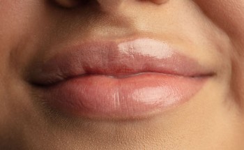 Um Guia Completo Sobre o Preenchimento Labial.